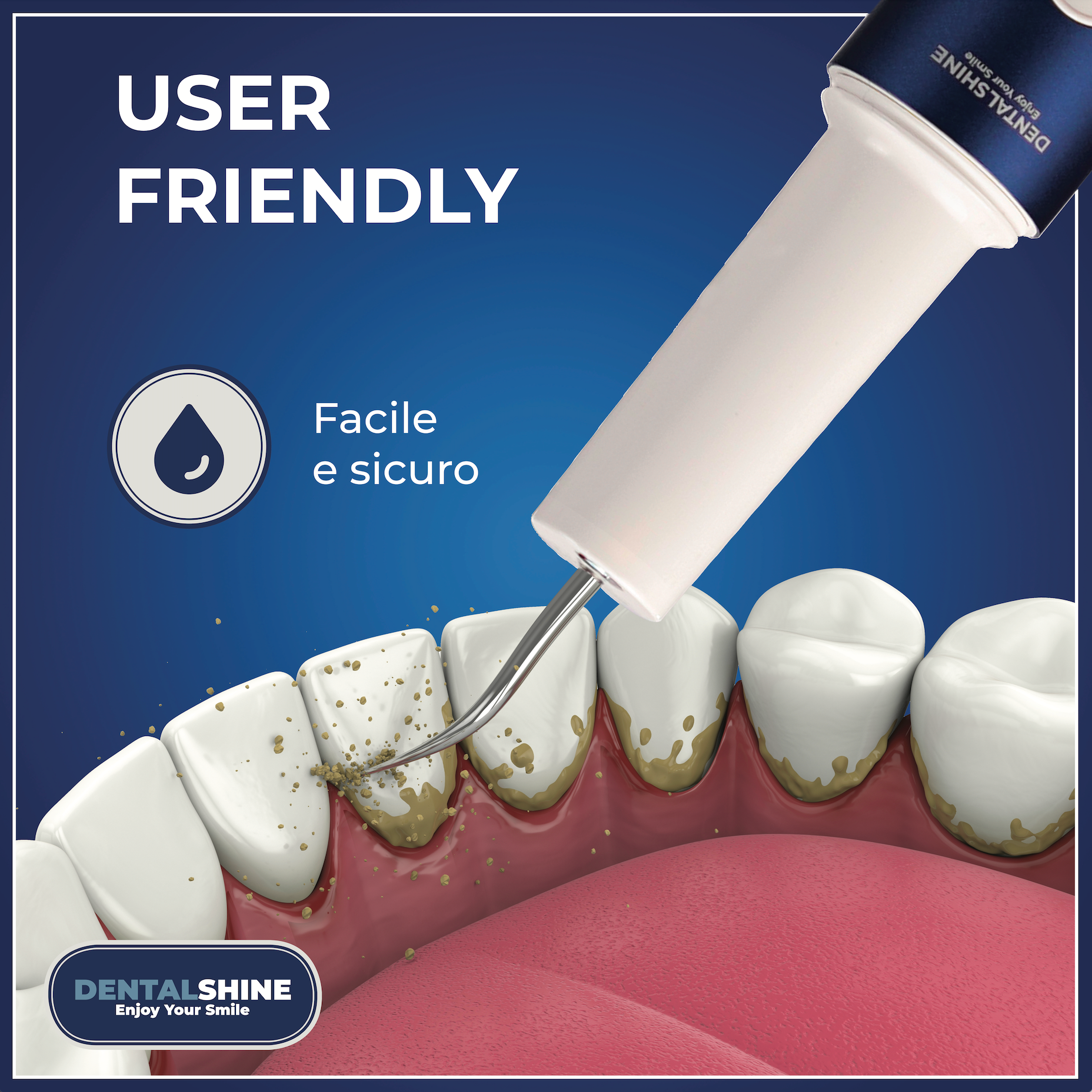 Un Sorriso più Bianco e una Bocca più Sana, Nuovo Ablatore a Ultrasuoni Dentalshine!