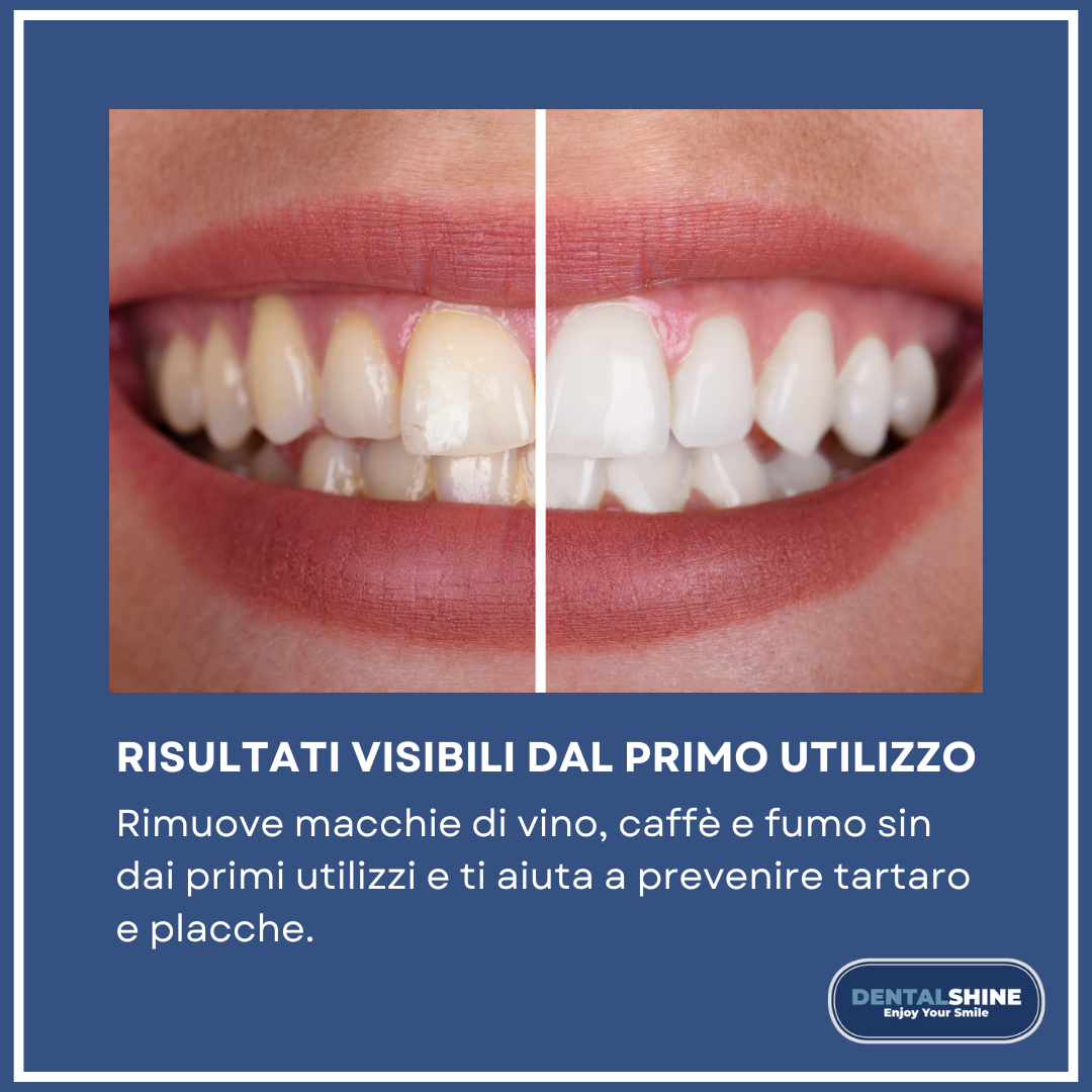 Explorer Dental - Acquista Explorer Dental Con Spedizione - Foto 4